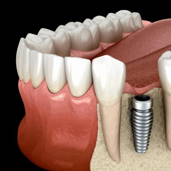 picture 2 -rctinpurnia