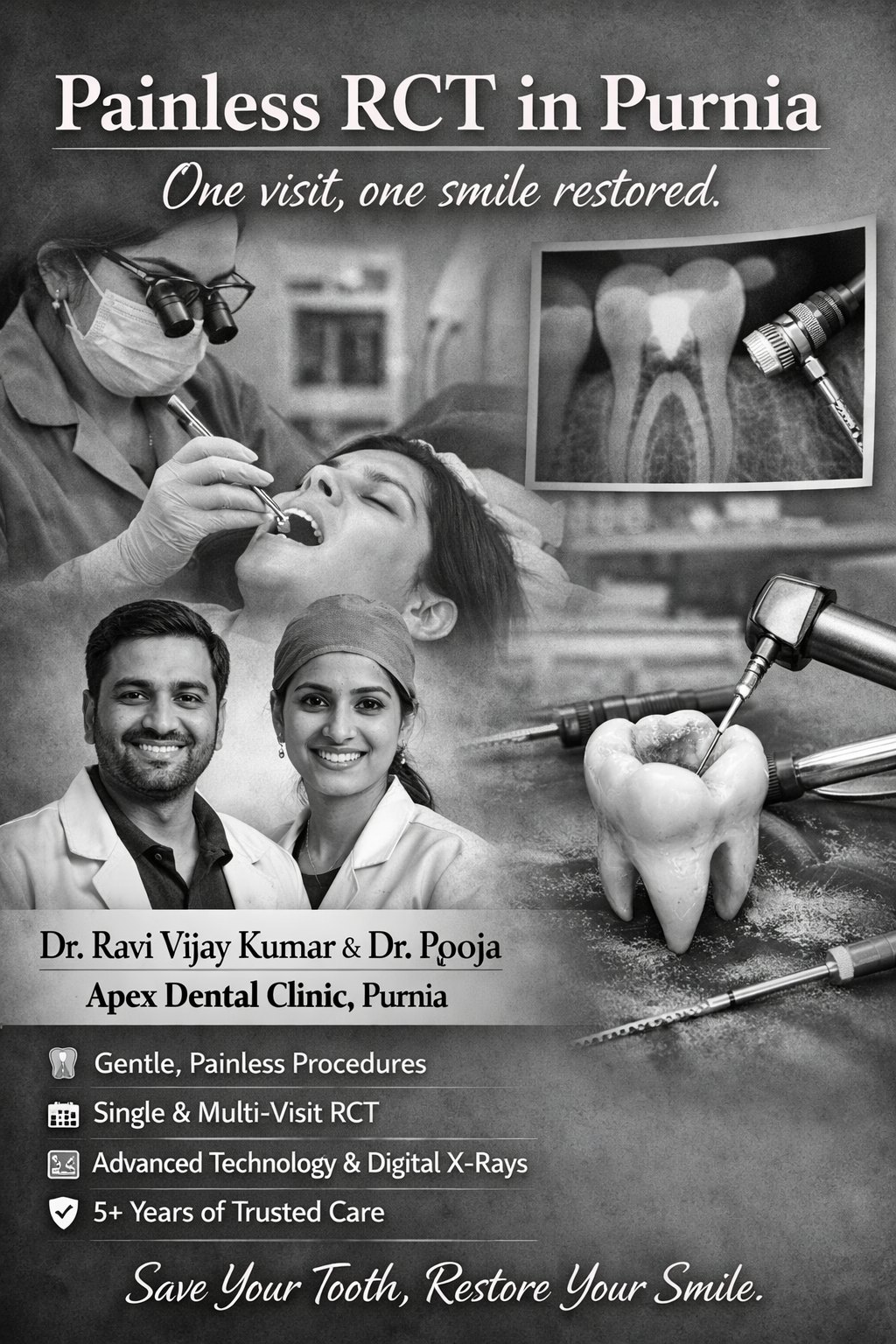 RCT - APEX DENTAL CLINIC Best Rct In Purnia Painless1