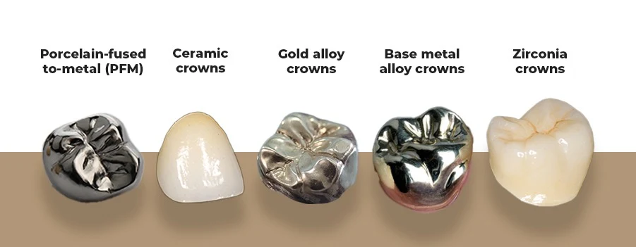 Precision Zirconia Dental Crown at Apex Dental
