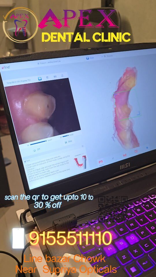 Instagram post from apexdent.in. This post is in position 6.