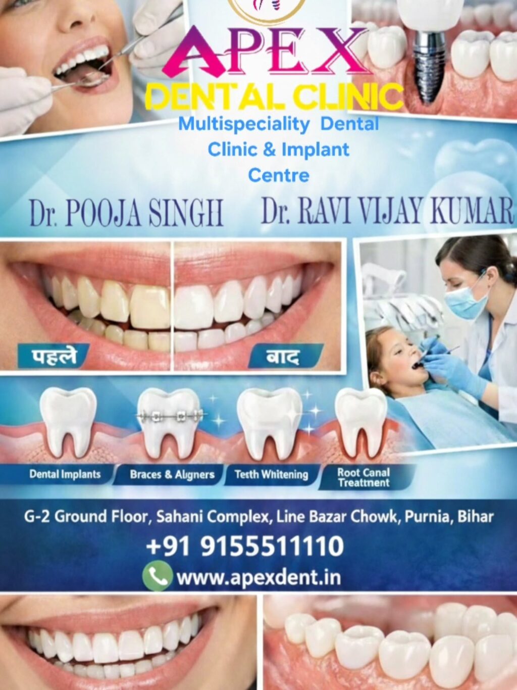 Instagram post from apexdent.in. This post is in position 6.